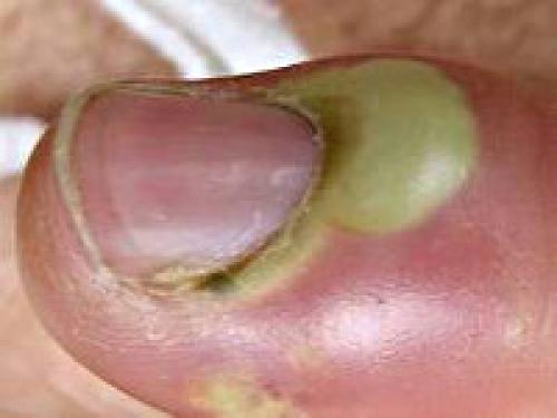 Опух палец на руке и покраснел. Цены на услуги