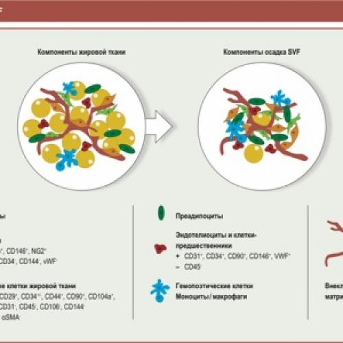 Уколы гиалуроновой кислоты в сустав. О чем расскажет молекулярная масса 02 Уколы гиалуроновой кислоты в сустав. О чем расскажет молекулярная масса 02