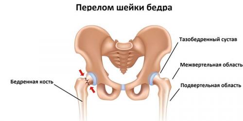 Как разрабатывать руку после перелома плечевого сустава: полное руководство 09 Как разрабатывать руку после перелома плечевого сустава: полное руководство 09