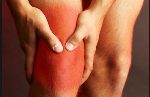 Почему болят суставы всего тела. Коллагенозы 03 Почему болят суставы всего тела. Коллагенозы 03