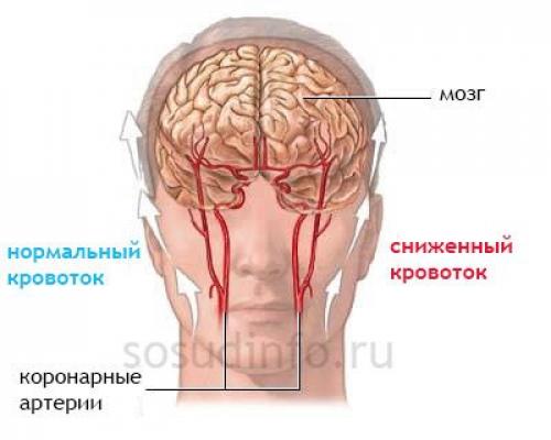 Нарушение кровообращения в конечностях. Определение болезни. Причины заболевания 05