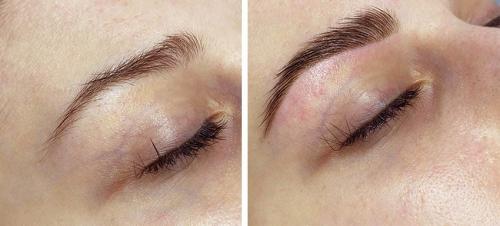 Топ-5 модных процедур для бровей в 2019 году 10 Топ-5 модных процедур для бровей в 2019 году 10