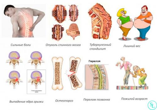 Как избавиться от боли в пояснице#39,#39, (мгновенно). Отличительные симптомы
