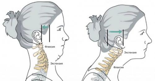 Лечение болей в шее. Руководство по лечению боли в шее