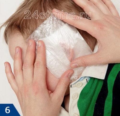 Компресс из димексида и новокаина пропорции. Компресс с димексидом и новокаином –