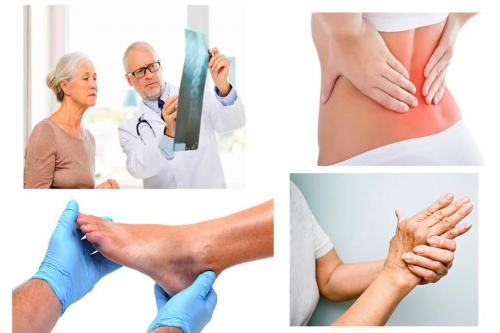 Компресс с димексидом для суставов. Особенности применения Димексида при заболеваниях суставов