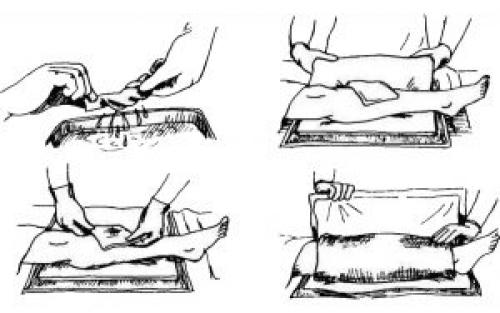 В каких случаях следует проконсультироваться с врачом перед применением компресса с димексидом. Как правильно развести димексид с водой