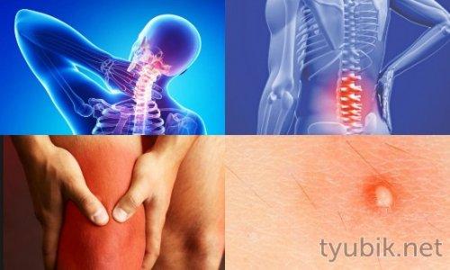 Эффективное лечение суставов: как правильно использовать компресс с димексидом 10 Эффективное лечение суставов: как правильно использовать компресс с димексидом 10